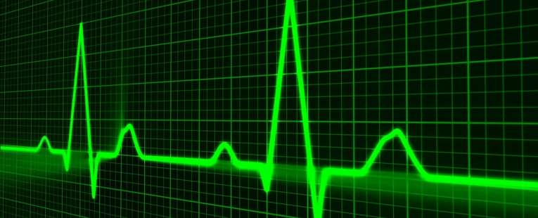 Puls serca